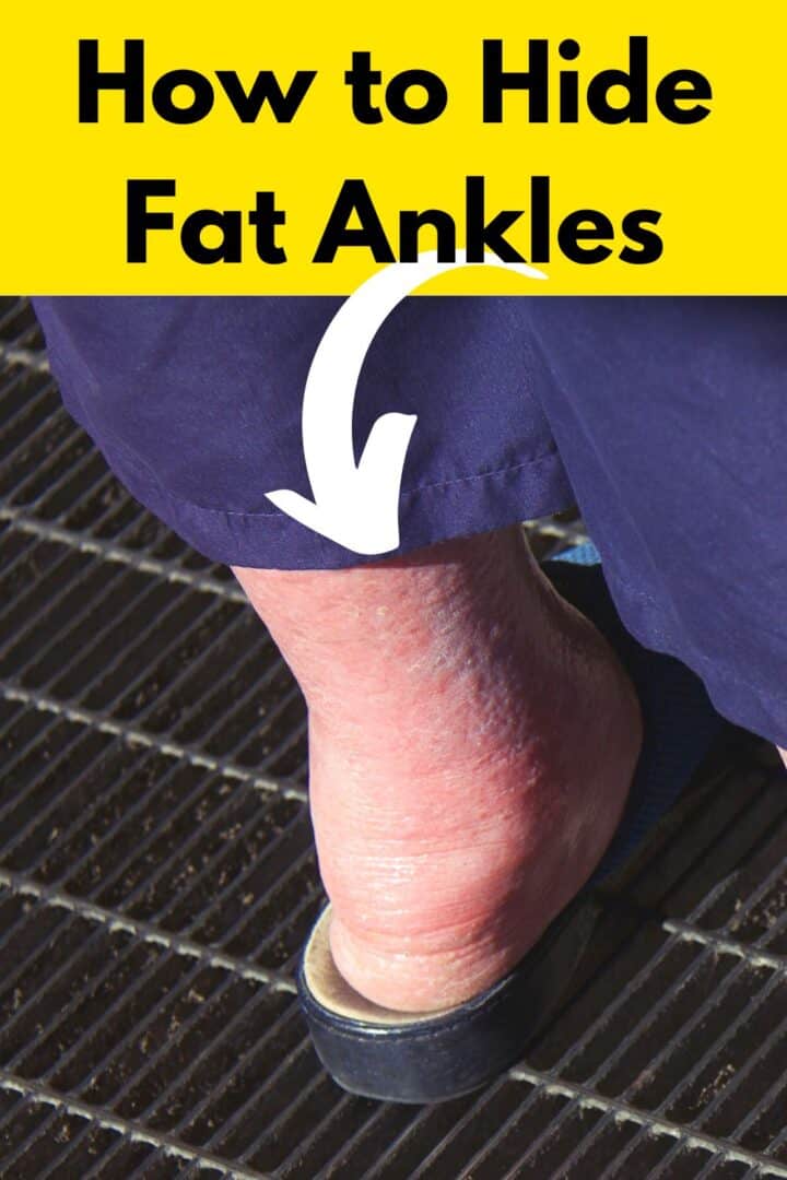 Stunning How Do You Get Rid Of Fat Ankles Moment Illustration Stunning How Do You Get Rid Of Fat Ankles Moment Illustration